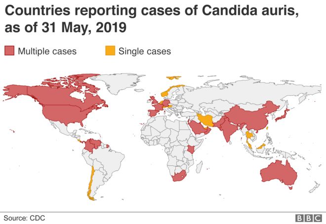 Карта случаев Candida auris