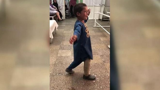 Плес дечака без ноге
