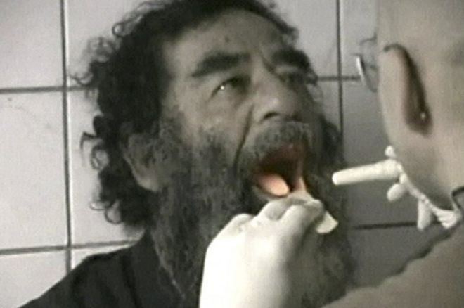 Саддама Хусейна осматривают после захвата