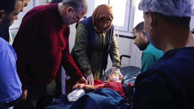 Mohammed Agid recibe tratamiento en el hospital al-Shifa de Afrin, en el noroeste de Siria.
