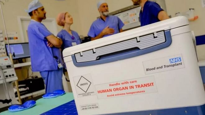 Organ donation