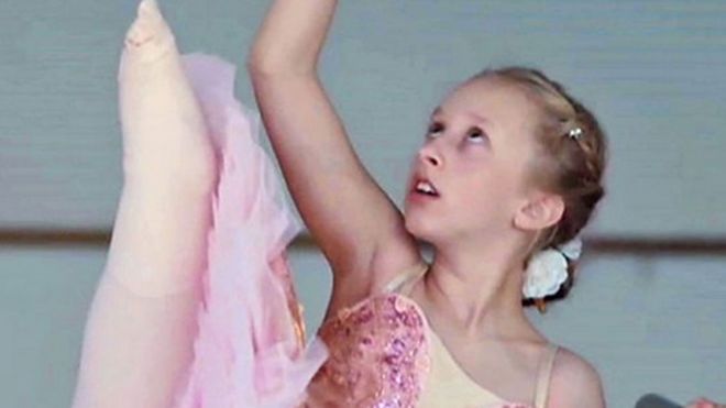 La historia de una niña que perdió una pierna a los 2 años y cumplió su sueño de ser bailarina