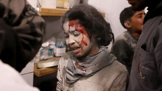 A Syrian girl receives treatment following a reported government air strike on the besieged Eastern Ghouta (7 March 2018)