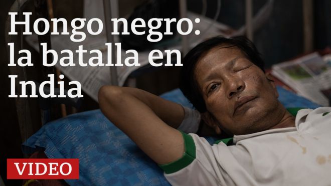 Hongo negro en India