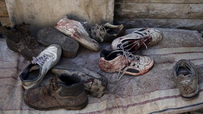 Запятнанные кровью туфли изображены после того, как сирийские правительственные силы выпустили ракеты по оживленной рыночной площади в районе Дума в Дамаске, Сирия, 30 октября 2015 года.