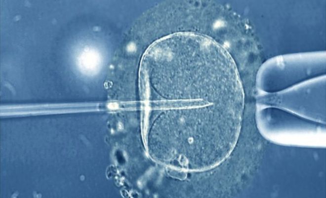 Человеческое яйцо, инъецированное микроиглой, содержащей единственную сперму