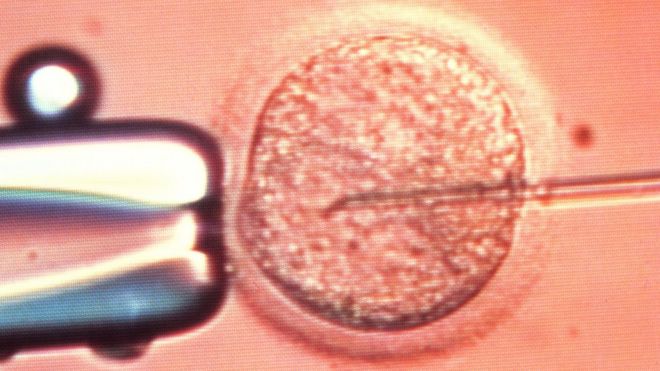 Микроскопическое изображение процесса экстракорпорального оплодотворения (ЭКО), при котором человеческому яйцеклетке (яйцеклетке) вводится сперма