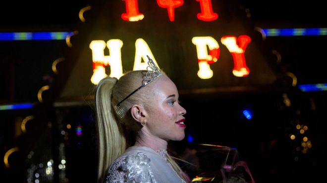 A portrait shot of Zimbabwe's first Miss Albino Sithembiso Mutukura wearing a crown and holding a bouquet after winning the the inaugural Miss Albinism beauty contest, early on March 17, 2018, in Harare.