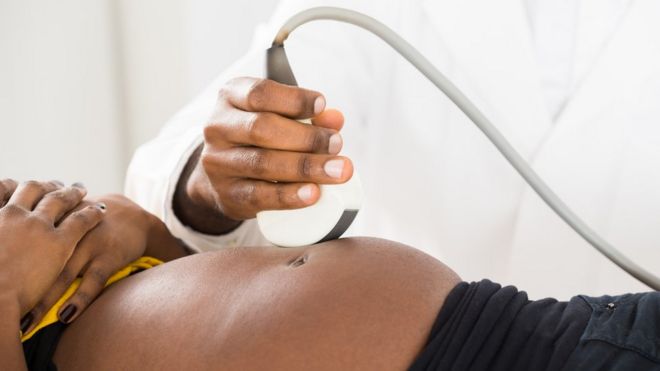 Ультразвуковое сканирование на беременность