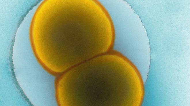 Цветная просвечивающая электронная микрофотография бактерий Neisseria meningitidis серогруппы C