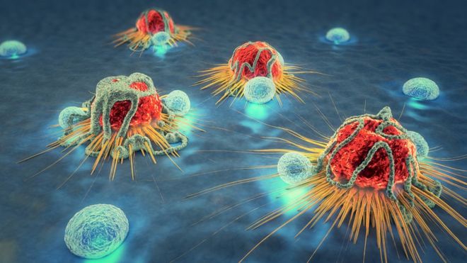 Células cancerosas sendo atacadas por linfócitos.