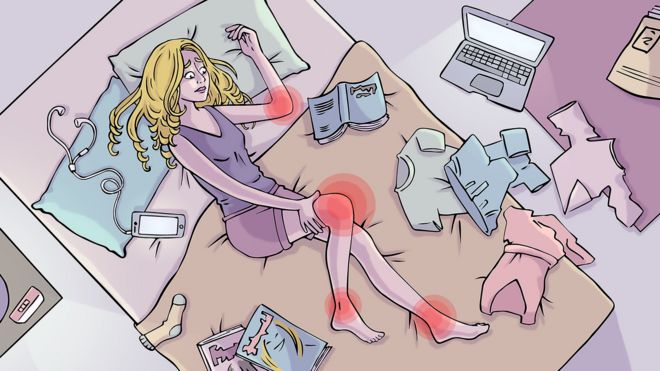 Иллюстрация Анжелы Кларк с синдромом Элерса-Данлоса.