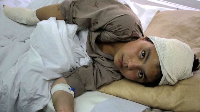 Afghan boy in hospital after a Taliban attack in Kabul, Afghanistan (19 April 2016)