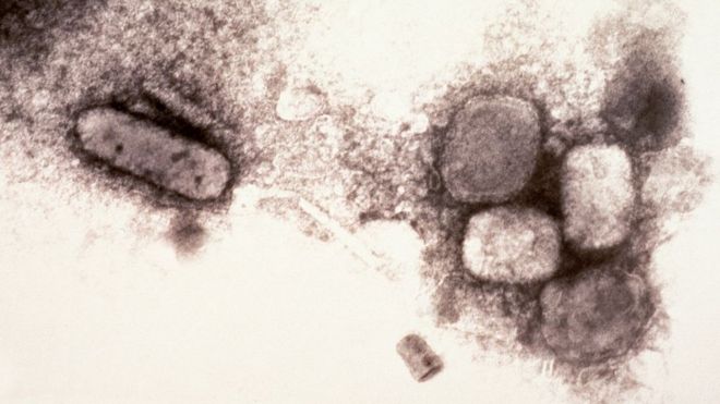 Электронная микрофотография вируса оспы (натуральной оспы), 1970 г.