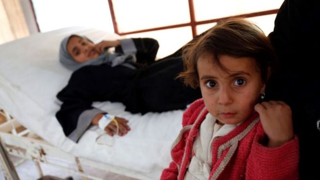 Yemen'de iki milyon kadar çocuk akut yetersiz beslenmeyle karşı karşıya.