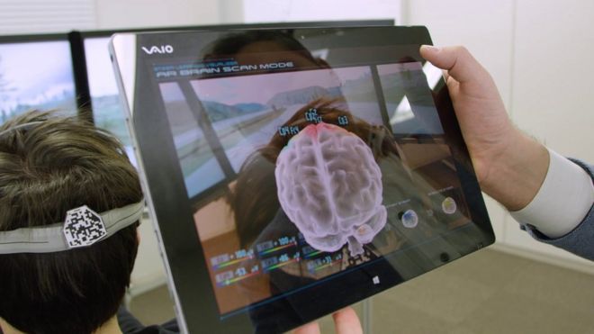 Ученый держит планшет с изображением мозга за головой испытуемого