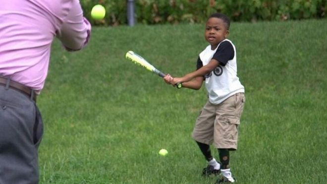 الطفل زيون هارفي يلعب البيسبول