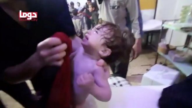 Sosyal medyada yayılan görüntülerde tedavi gören çocuklar yer alıyor