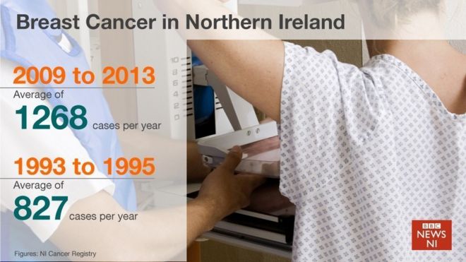 Статистика случаев рака молочной железы в Северной Ирландии