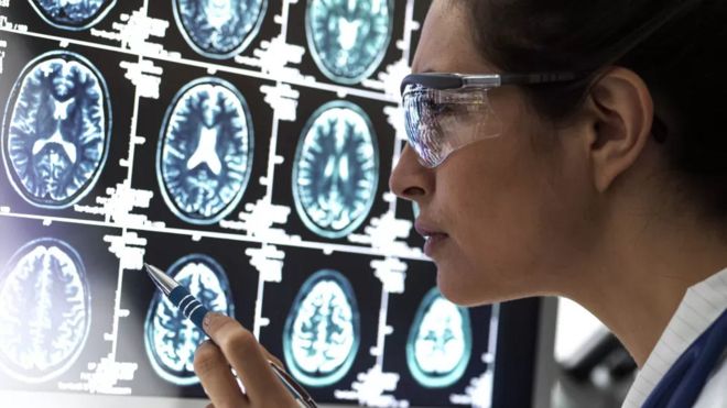Una doctora examina resonancias de un cerebro