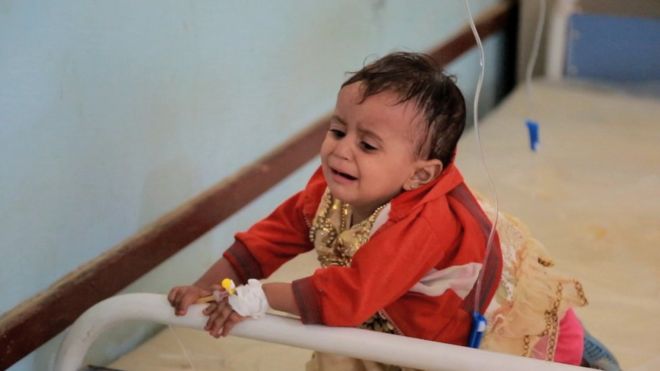 طفلة في اليمن