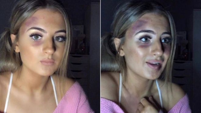 Два изображения Эмбер показывают, что количество макияжа на ее лице увеличивается, чтобы создать впечатление, будто на нее напали.
