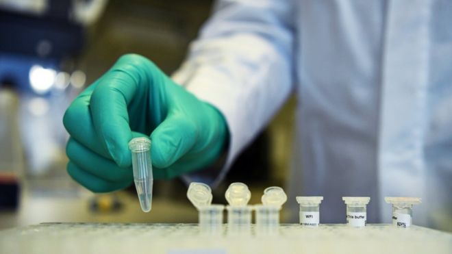 Istraživač nemačke farmaceutske kompanije demonstrira testiranje na virus