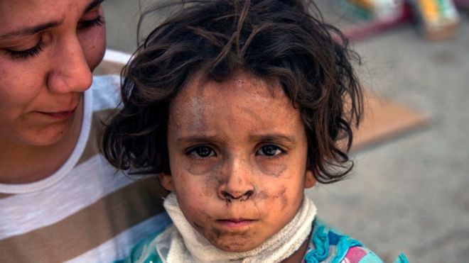 Una niña herida en Mosul