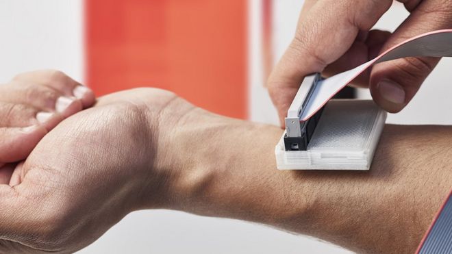 The skin cancer detecting device being used on a man's arm