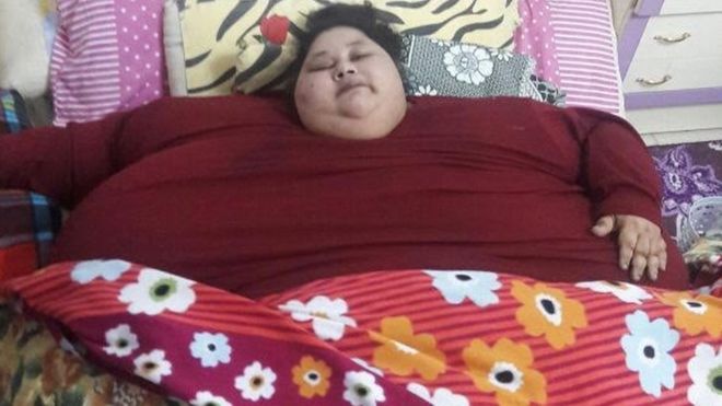 Cea mai obeză femeie din lume pierde de kilograme după două luni de tratament El Diario Vasco