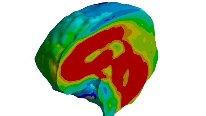 Фотография мозга через 10 миллисекунд после удара. Области высокого напряжения отображаются красным цветом