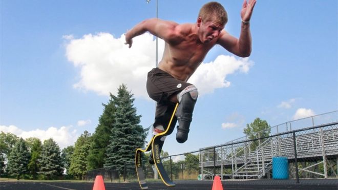 paralympian runner A.J. Digby takes off in a full sprint during a workout at the Eastwood High School track in Pemberville, Ohio. He will compete in the 2016 Paralympics in Rio de Janeiro. (Cameron Hart/The Blade via AP)