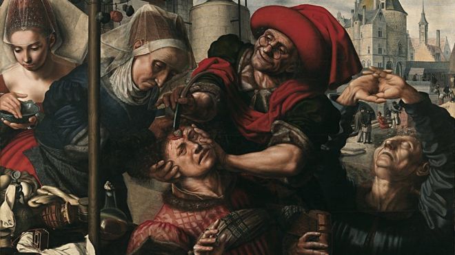Cirugía, 1550-1555. Artista: Jan Sanders van Hemessen.