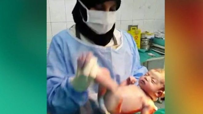 Obstetra durante una cesárea en Alepo