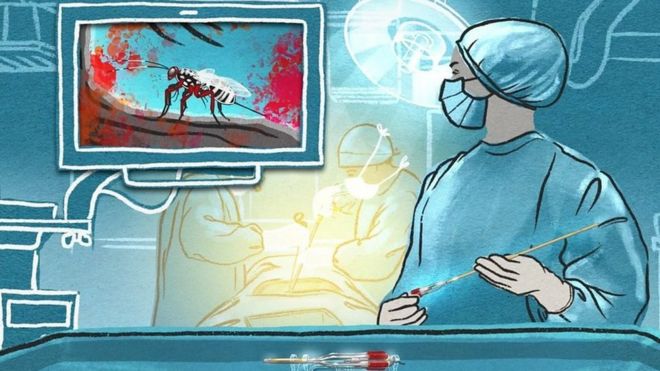Ilustração de cirurgião segurando instrumento e olhando para tela com imagem de uma vespa