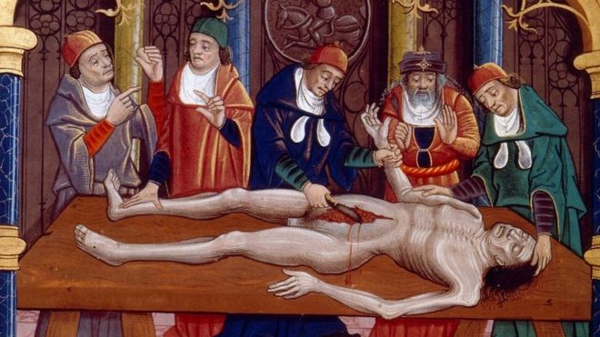 Ilustración medieval de una autopsia realizada en la edad media. Del manuscrito francés "Las propiedades de las cosas" de Bartholomaeus Anglicus, finales del siglo XV.