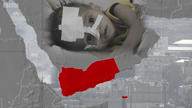 Niño en hospital y mapa de Yemen