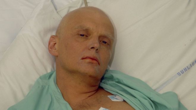 Александр Литвиненко на снимке в отделении интенсивной терапии, отделение интенсивной терапии, Университетская больница, 20 ноября 2006 года в Лондоне, Англия