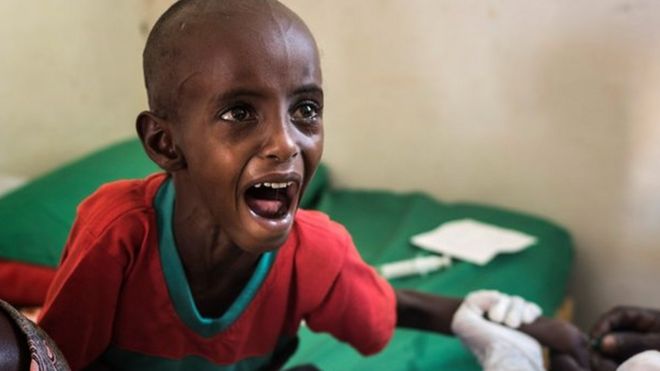 El pequeño Abdullahi Mohamud llora al recibir una inyección.