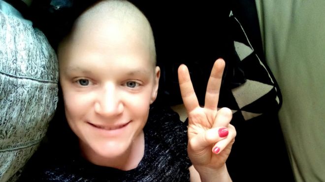 Primer plano de Kristina Svensson durante el tratamiento de quimioterapia