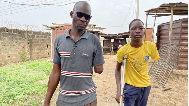 Malaolu Oluseye wey come from Idi-Ori for Ogun State, for Nigeria southwest na welder wey accident for 2019 see him and e son undergo many operation and amputation.