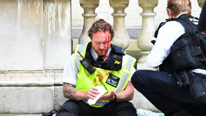 Полицейский получает медицинскую помощь после столкновения полиции с демонстрантами в Уайтхолле