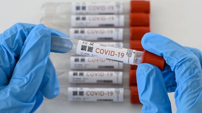 Tests de coronavirus: cómo son las pruebas serológicas y ...