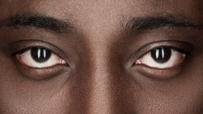 Olhos de homem negro