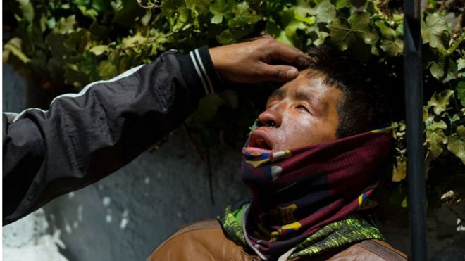 El rostro de un manifestante herido en el noveno día de protestas en Ecuador.