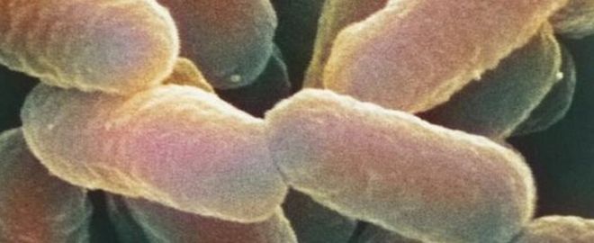 Цветная растровая электронная микрофотография (СЭМ) Escherichia coli 0157: H7