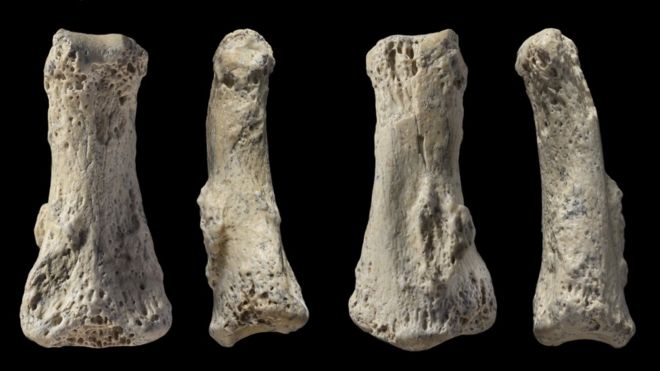 Four images showing different sides of a finger bone