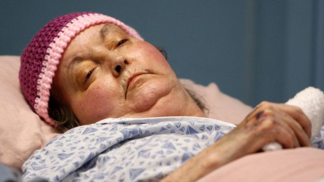 Сьюзен Аткинс в больнице незадолго до своей смерти