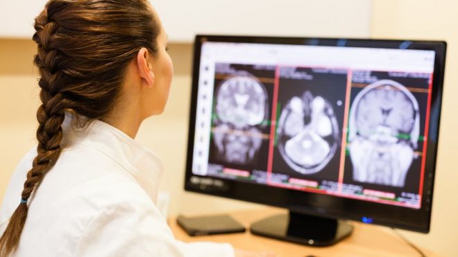 Женщина-врач смотрит на МРТ