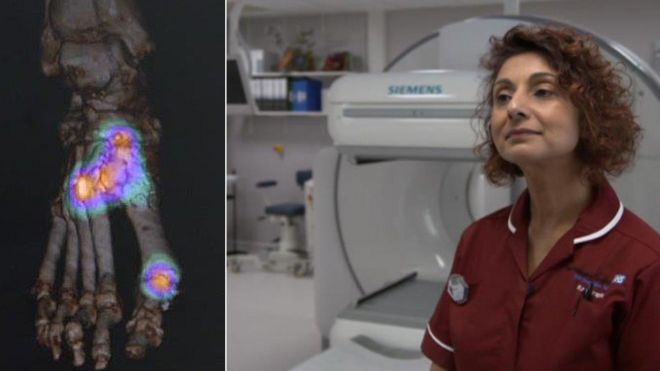 Изображение с гибридного сканера, который выполняет работу двух одновременно, с рентгенологом Лубной Хуссейн